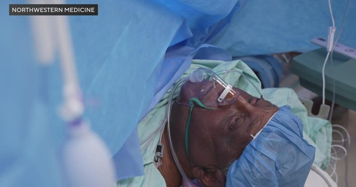 74-Year-Old Man Undergoes Awake Kidney Transplant