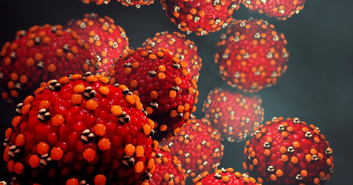 Seventh Measles Case Confirmed in Michigan