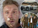 Freddie Flintoff Reveals Injuries After Top Gear Crash