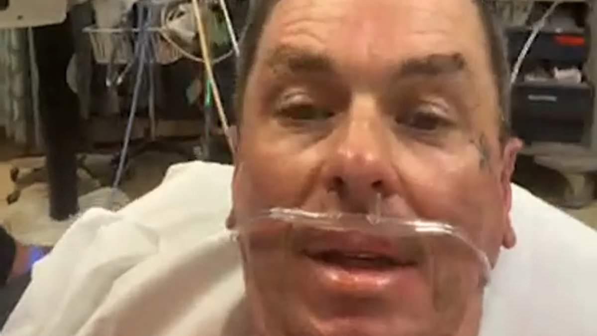 Slipknot's Sid Wilson Recovering from Severe Burns