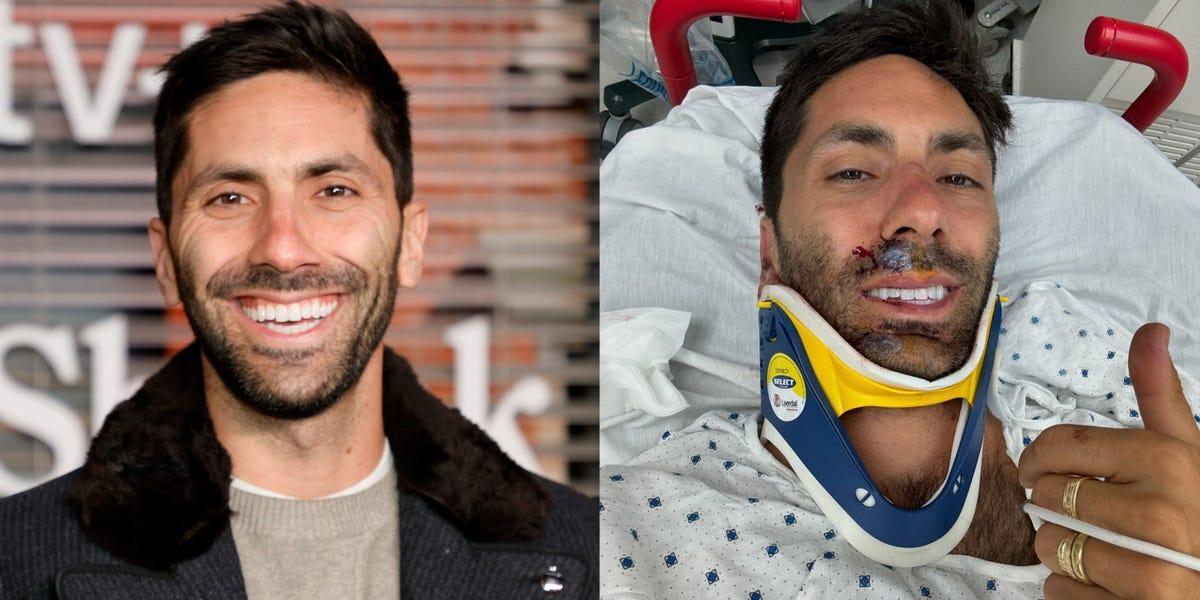 Nev Schulman Breaks Neck in Biking Accident