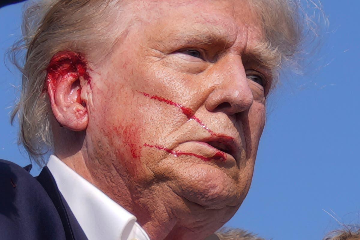 Concerns Over Trump's Health After Assassination Attempt